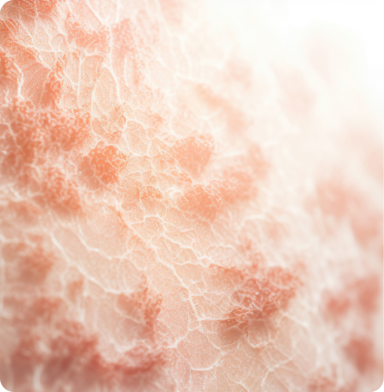 Close up of skin, depicting chronic skin condition.